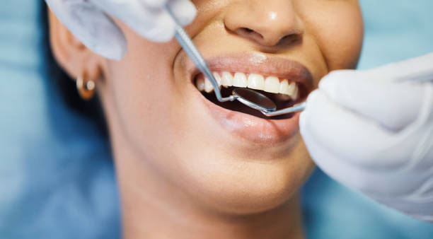 Best Dentist for Tooth Abscess  in Shadybrook, TX